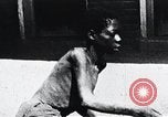 Image of sleeping sickness Congo, 1940, second 62 stock footage video 65675032245