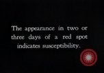 Image of prevention of diseases United States USA, 1924, second 14 stock footage video 65675032276