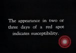Image of prevention of diseases United States USA, 1924, second 19 stock footage video 65675032276
