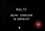 Immagine di Causa di malattie dei microrganismi United States USA, 1922, secondo 5 filmato di repertorio 65675032292