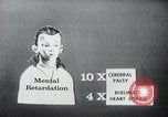 Image of Mental Disabilities United States USA, 1969, second 12 stock footage video 65675033419