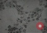 Immagine di Bomba atomica vittime Hiroshima Giappone, 1945, secondo 47 filmato di repertorio 65675036295