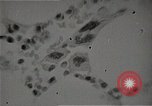 Immagine di Bomba atomica vittime Hiroshima Giappone, 1945, secondo 57 filmato di repertorio 65675036295