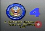 Image of cure for baldness in men United States USA, 1990, second 3 stock footage video 65675036379