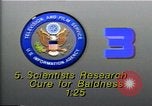 Image of cure for baldness in men United States USA, 1990, second 4 stock footage video 65675036379