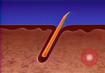 Image of cure for baldness in men United States USA, 1990, second 26 stock footage video 65675036379