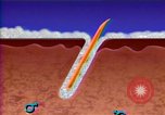 Image of cure for baldness in men United States USA, 1990, second 28 stock footage video 65675036379