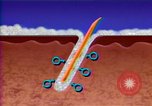 Image of cure for baldness in men United States USA, 1990, second 29 stock footage video 65675036379