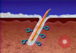 Image of cure for baldness in men United States USA, 1990, second 31 stock footage video 65675036379