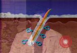Image of cure for baldness in men United States USA, 1990, second 34 stock footage video 65675036379