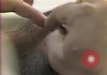 Image of cure for baldness in men United States USA, 1990, second 44 stock footage video 65675036379