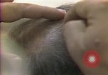 Image of cure for baldness in men United States USA, 1990, second 46 stock footage video 65675036379