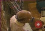 Image of cure for baldness in men United States USA, 1990, second 57 stock footage video 65675036379