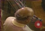 Image of cure for baldness in men United States USA, 1990, second 58 stock footage video 65675036379