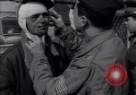 Image of Soldier with wounded bandaged face Belgrade Yugoslavia, 1945, second 55 stock footage video 65675040255