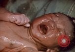Standbild baby Lieferung Kingston Jamaika, 1972, aus Sekunde 48 historischem Filmmaterial Videoclip 65675040549