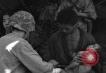 Image of injured Japanese children Okinawa Ryukyu Islands, 1945, second 48 stock footage video 65675042089