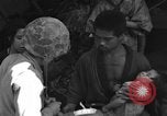 Image of injured Japanese children Okinawa Ryukyu Islands, 1945, second 53 stock footage video 65675042089