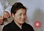 Image of Japanese nurse with atomic bomb scars Hiroshima Japan, 1945, second 14 stock footage video 65675042171