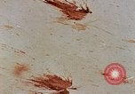 Image of Japanese nurse Hiroshima Japan, 1946, second 36 stock footage video 65675042172