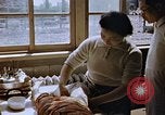 Image les blessures aux jambes de bombe atomique Hiroshima au Japon, 1945, de la seconde 3 séquences d'archives historiques vidéo 65675042173