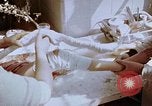 Image les blessures aux jambes de bombe atomique Hiroshima au Japon, 1945, de la seconde 33 séquences d'archives historiques vidéo 65675042173