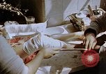 Image les blessures aux jambes de bombe atomique Hiroshima au Japon, 1945, de la seconde 35 séquences d'archives historiques vidéo 65675042173