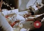 Image les blessures aux jambes de bombe atomique Hiroshima au Japon, 1945, de la seconde 36 séquences d'archives historiques vidéo 65675042173