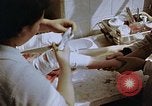 Image les blessures aux jambes de bombe atomique Hiroshima au Japon, 1945, de la seconde 40 séquences d'archives historiques vidéo 65675042173
