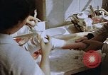 Image les blessures aux jambes de bombe atomique Hiroshima au Japon, 1945, de la seconde 45 séquences d'archives historiques vidéo 65675042173