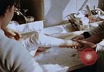 Image les blessures aux jambes de bombe atomique Hiroshima au Japon, 1945, de la seconde 54 séquences d'archives historiques vidéo 65675042173