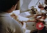 Image les blessures aux jambes de bombe atomique Hiroshima au Japon, 1945, de la seconde 59 séquences d'archives historiques vidéo 65675042173