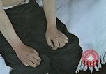 Standbild Haarausfall Nagasaki Japan, 1946, aus Sekunde 4 historischem Filmmaterial Videoclip 65675042176