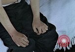 Standbild Haarausfall Nagasaki Japan, 1946, aus Sekunde 6 historischem Filmmaterial Videoclip 65675042176