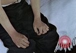 Standbild Haarausfall Nagasaki Japan, 1946, aus Sekunde 11 historischem Filmmaterial Videoclip 65675042176