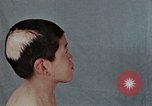 Standbild Haarausfall Nagasaki Japan, 1946, aus Sekunde 18 historischem Filmmaterial Videoclip 65675042176