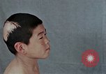 Standbild Haarausfall Nagasaki Japan, 1946, aus Sekunde 19 historischem Filmmaterial Videoclip 65675042176