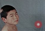 Standbild Haarausfall Nagasaki Japan, 1946, aus Sekunde 21 historischem Filmmaterial Videoclip 65675042176