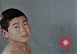 Standbild Haarausfall Nagasaki Japan, 1946, aus Sekunde 22 historischem Filmmaterial Videoclip 65675042176