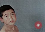 Standbild Haarausfall Nagasaki Japan, 1946, aus Sekunde 23 historischem Filmmaterial Videoclip 65675042176