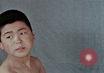 Standbild Haarausfall Nagasaki Japan, 1946, aus Sekunde 24 historischem Filmmaterial Videoclip 65675042176