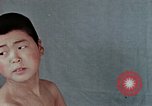 Standbild Haarausfall Nagasaki Japan, 1946, aus Sekunde 25 historischem Filmmaterial Videoclip 65675042176