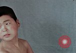 Standbild Haarausfall Nagasaki Japan, 1946, aus Sekunde 26 historischem Filmmaterial Videoclip 65675042176