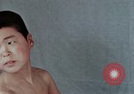 Standbild Haarausfall Nagasaki Japan, 1946, aus Sekunde 27 historischem Filmmaterial Videoclip 65675042176