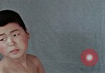 Standbild Haarausfall Nagasaki Japan, 1946, aus Sekunde 29 historischem Filmmaterial Videoclip 65675042176