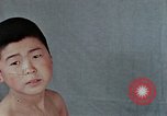 Standbild Haarausfall Nagasaki Japan, 1946, aus Sekunde 30 historischem Filmmaterial Videoclip 65675042176