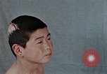 Standbild Haarausfall Nagasaki Japan, 1946, aus Sekunde 33 historischem Filmmaterial Videoclip 65675042176