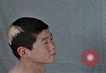 Standbild Haarausfall Nagasaki Japan, 1946, aus Sekunde 34 historischem Filmmaterial Videoclip 65675042176