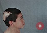 Standbild Haarausfall Nagasaki Japan, 1946, aus Sekunde 35 historischem Filmmaterial Videoclip 65675042176