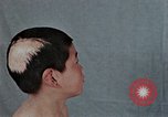 Standbild Haarausfall Nagasaki Japan, 1946, aus Sekunde 37 historischem Filmmaterial Videoclip 65675042176